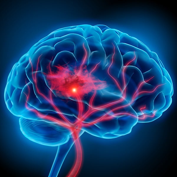 image of a brain